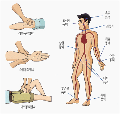 상지의 출혈 ⇒ 상완동맥, 압박손의 출혈 ⇒ 요골동맥, 압박하지의 출혈 ⇒ 대퇴동맥 압박