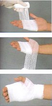 손에 붕개를 감는 방법 엄지를 제외한 부위를 먼저 감고 교차하여 손목부분까지 감는다.
