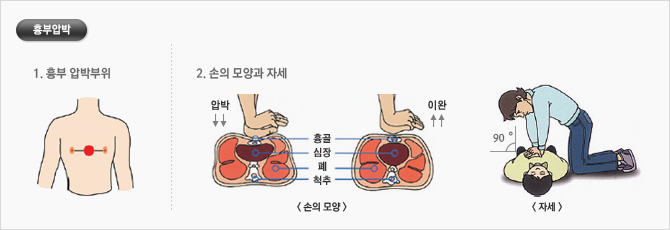 흉부압박 부위는 양쪽유듀를 이은 가상선 흉골의 중심부를 말합니다. 손모양과 자세는  양손을 평행하게 깍지를 끼고 손꿈치에서 흉골쪽을 압박합니다.