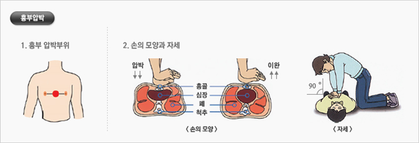 흉부압박 : 1. 흉부 압박부위 2. 손의 모양과 자세