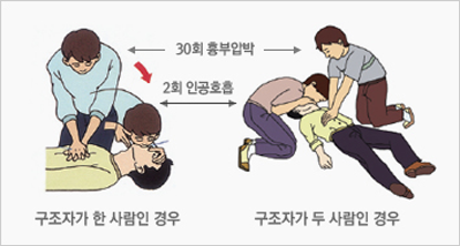 구조자가 한 사람인 경우 30회 흉부압박, 2회 인공호흡을 한다. 구조자가 두 사람인 경우 한 사람은 30회 흉부압박을 하고 다른 사람은 2회 인공호흡을 한다.